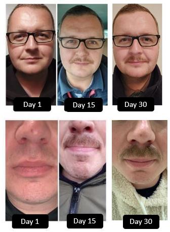 Movember Team